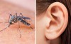原來蚊子老在耳邊嗡嗡叫是因為「被腥臭味吸引」  防蚊妙招學起來蚊子不再煩你
